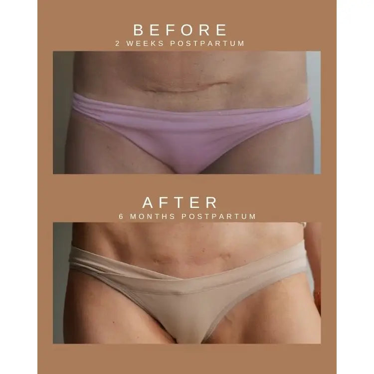Restorative Scar Treatment